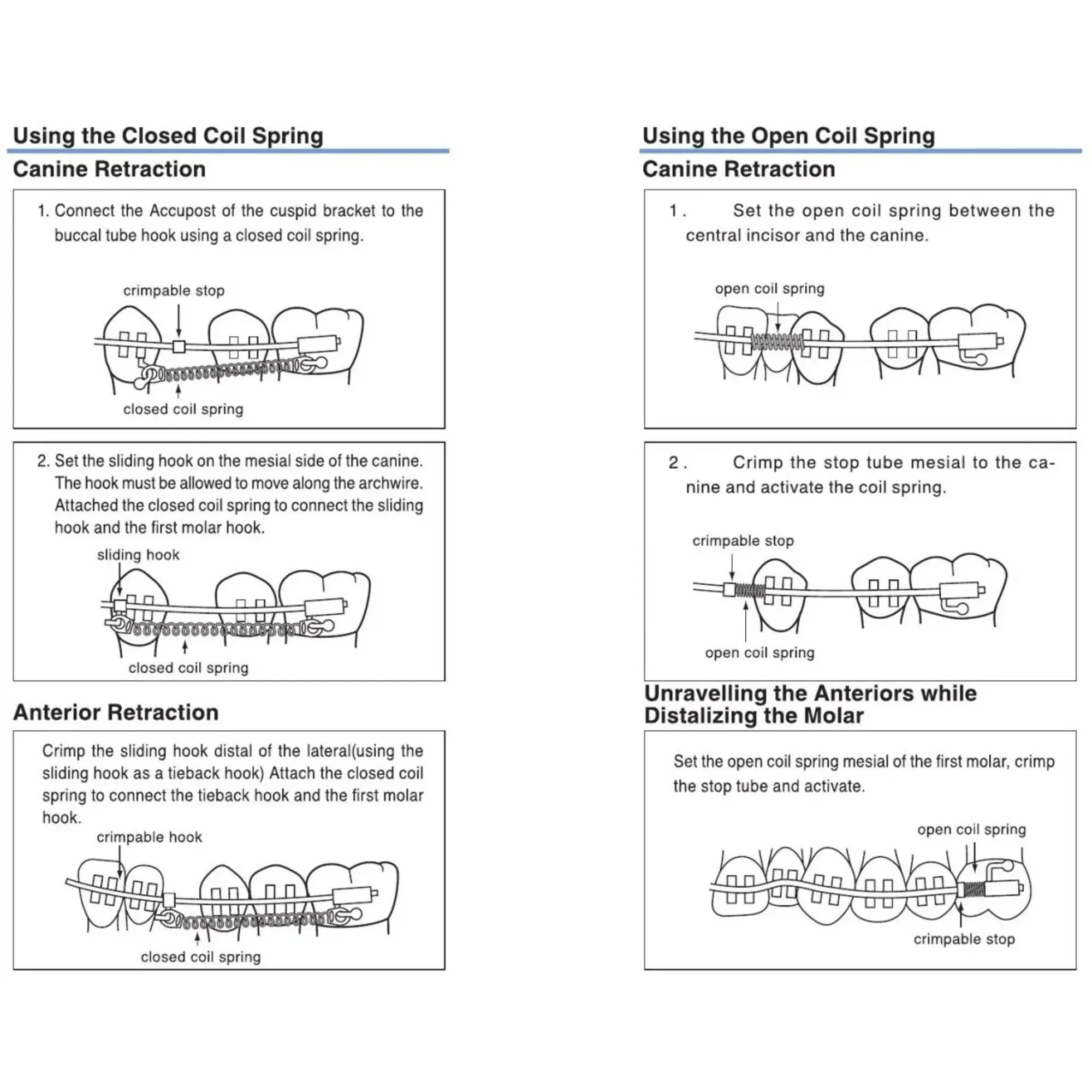 Tomy Open coil spring